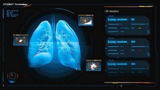 为了我们的健康 以AI赋能智能抗疫，数据处理与存储支持服务探析